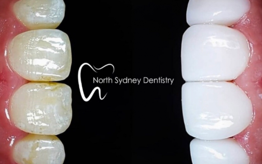 North Sydney Dentistry – 7 locations